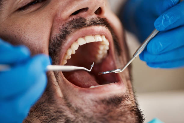 Best Broken Tooth Emergency  in Clemmons, NC